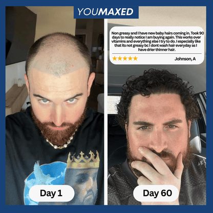 YouMaxed™ Hair Growth Serum - bebodywise - us.com