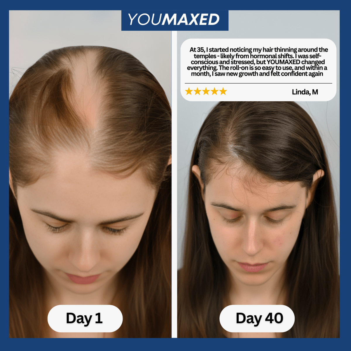 YouMaxed™ Hair Growth Serum - bebodywise - us.com
