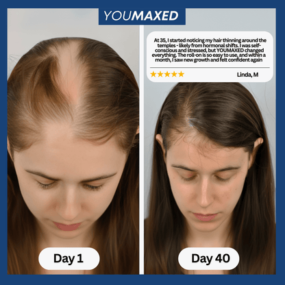 YouMaxed™ Hair Growth Serum - bebodywise - us.com